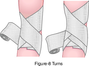 Bandages : définition, technique 