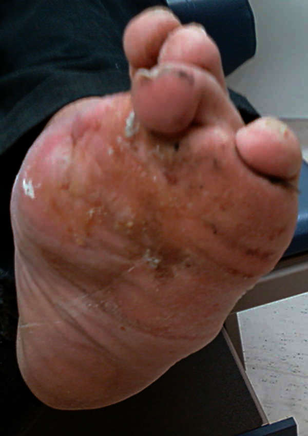 neuropathy | Taber's Medical Dictionary