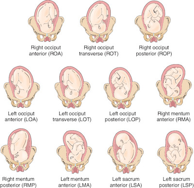 what does presentation of foetus mass mean