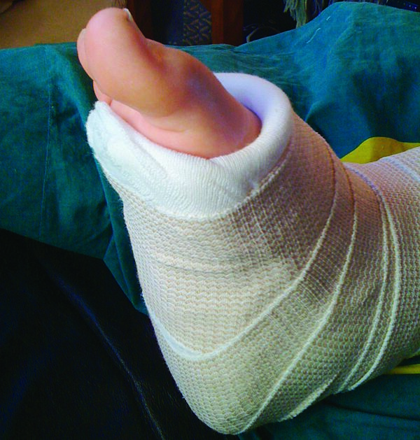 splint Taber's Medical Dictionary