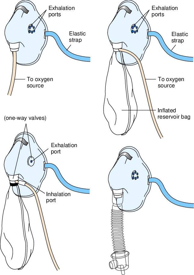 Different kinds deals of oxygen masks