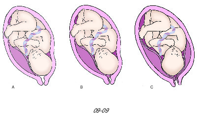 View of the discoid-in-shape, hemochorial and deciduate placenta of a