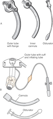 Tracheostomy 